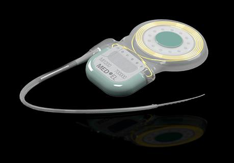 SYNCHRONY Cochlear Implant SYNCHRONY Cochlear Implant black