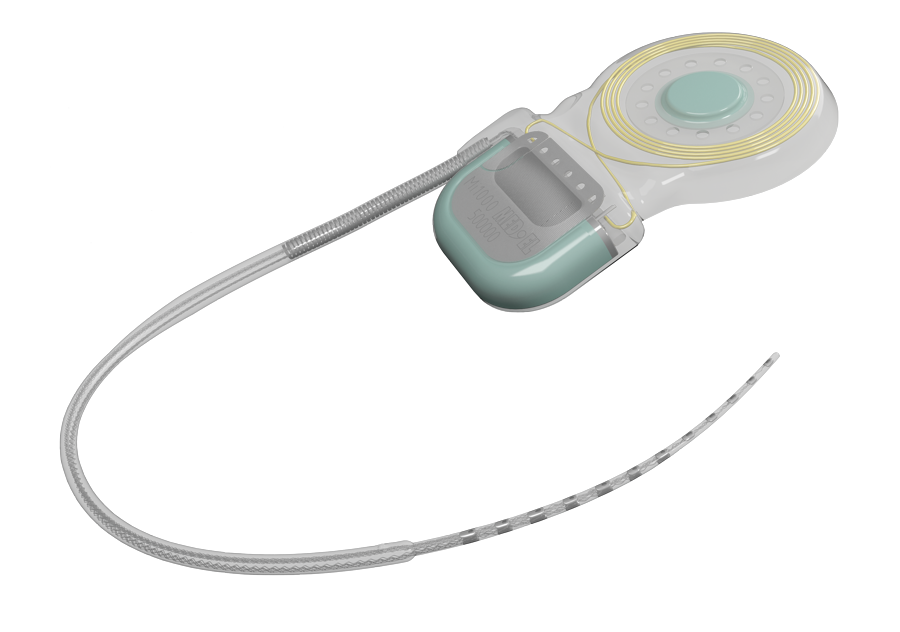 CONCERTO Cochlear Implant CONCERTO Cochlear Implant