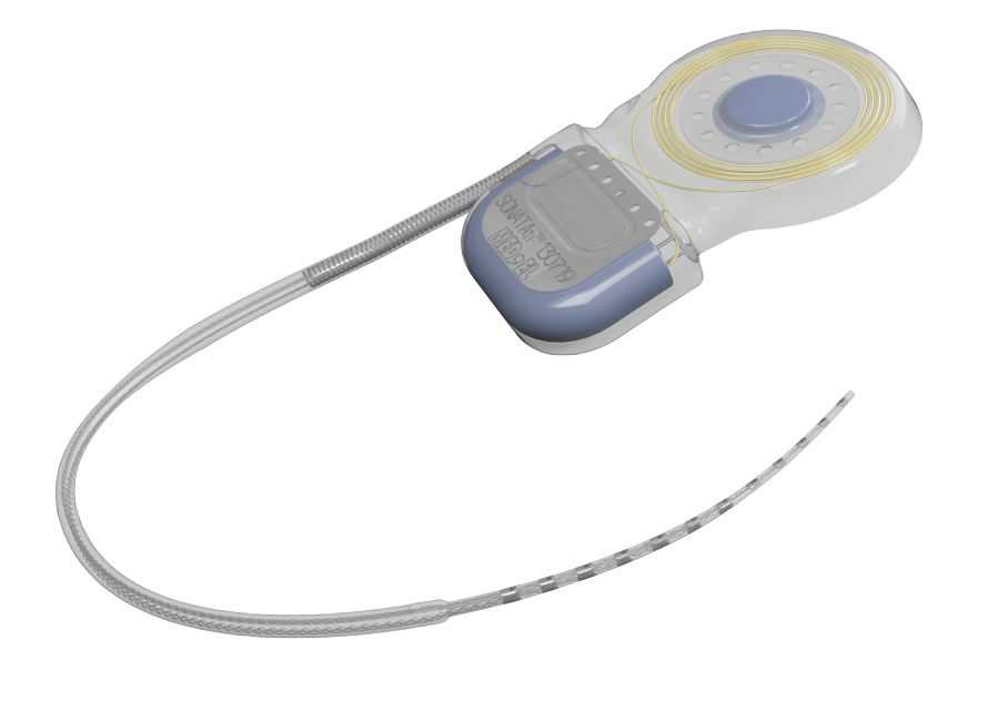 SONATA Cochlear Implant SONATA Cochlear Implant