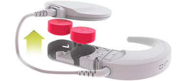 Sonnet-Battery-Remove Sonnet-Battery-Remove