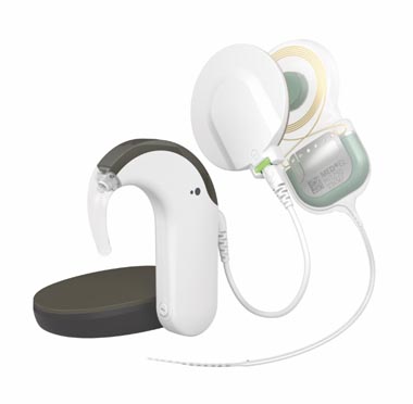 cochlear implant system