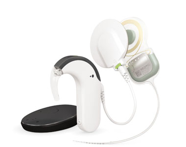 MED-EL Audio Processors MED-EL Audio Processors