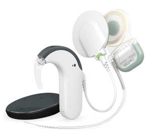 MED-EL Audio Processors MED-EL Audio Processors