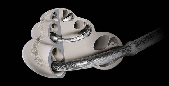 synchrony_implant_cochlear_triformance synchrony_implant_cochlear_triformance