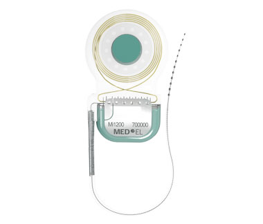 Cochlear Implant Comparison Chart 2018