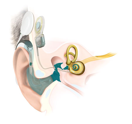 Ear Anatomy SONNET 2 EAS Ear Anatomy SONNET 2 EAS