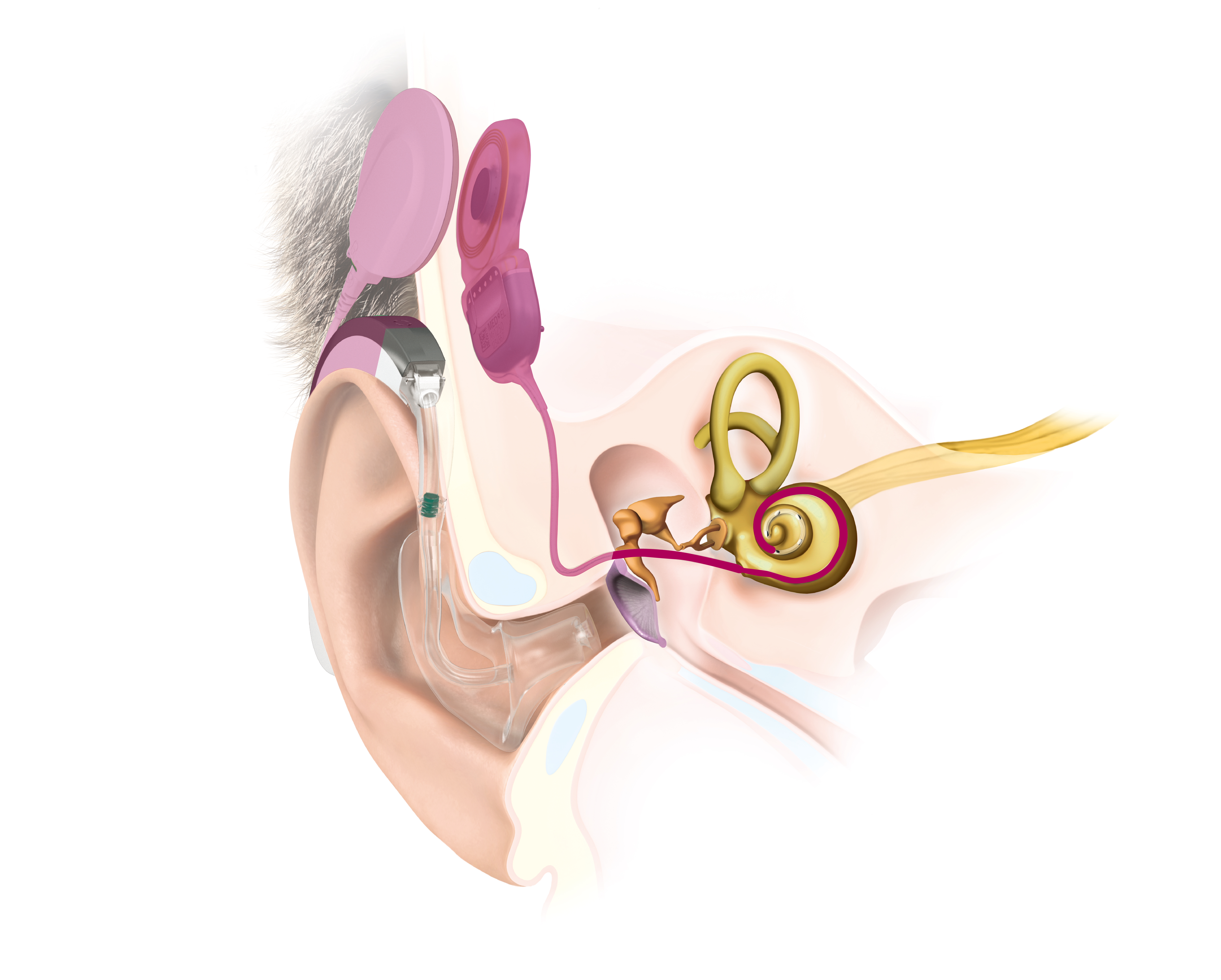 Ear Anatomy SYNCHORNY 2 EAS Ear Anatomy SYNCHORNY 2 EAS
