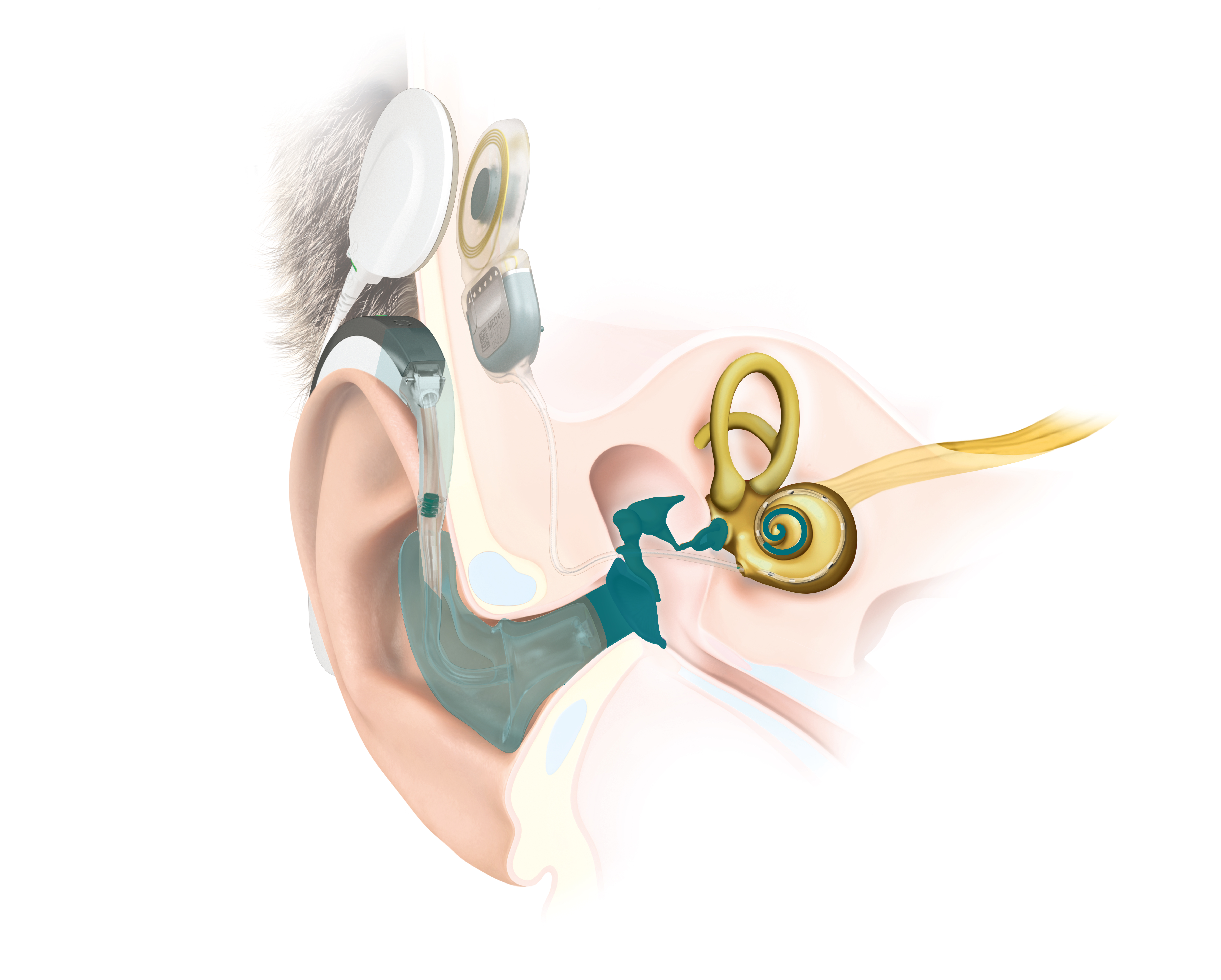 Ear Anatomy SONNET 2 EAS Ear Anatomy SONNET 2 EAS
