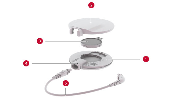 SONNET 2 DL-Coil SONNET 2 DL-Coil